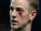 Manchester City's English goalkeeper Joe Hart leaves the pitch sporting a cut to his face after the English Premier League football match against Crystal Palace on December 28, 2013