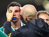 Jonathan Sexton of Ireland is given treatment for a cut to his eye during the RBS Six Nations match between Ireland and France at Aviva Stadium on February 14, 2015