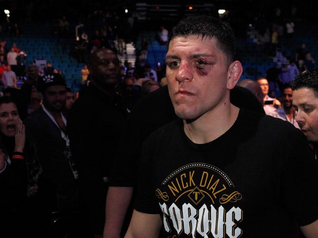Nick Diaz leaves the arena after losing to Anderson Silva in a middleweight bout during UFC 183 at the MGM Grand Garden Arena on January 31, 2015