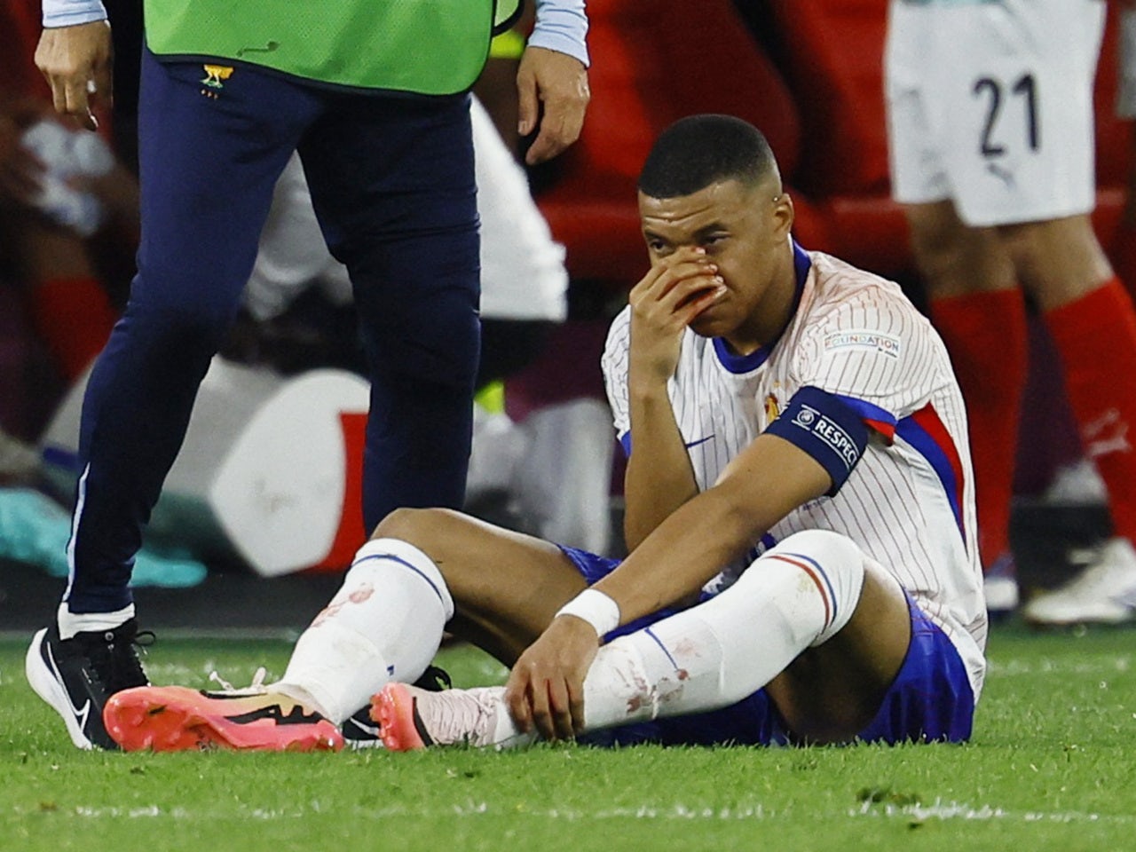 France star Kylian Mbappe 'likely to miss' Euro 2024 Netherlands clash